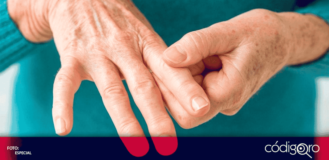 Alimentos ideales para personas con Artritis Reumatoide