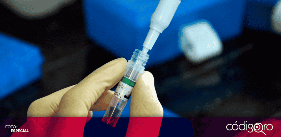 Neumonía causada por Covid-19 podría tratarse con células madre