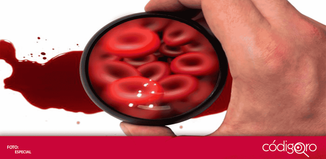 ¿Conoces cuáles son las causas y tipos de anemia?