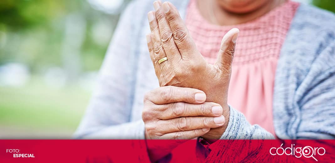 Buena alimentación, ejercicio y dieta rica en calcio; claves para prevenir osteoporosis