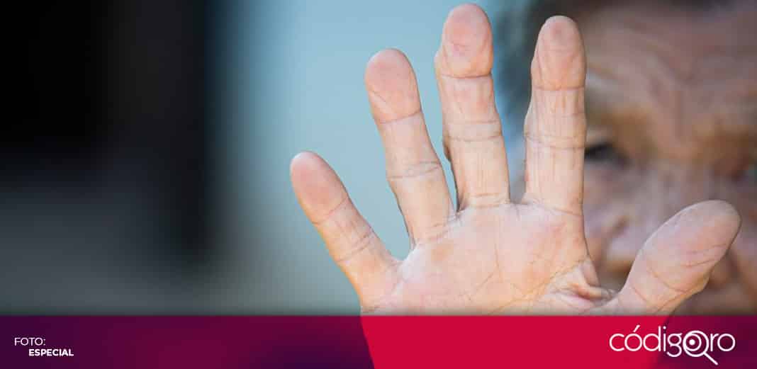 La ciencia no ha bajado la guardia ni se ha conformado frente al combate del Alzheimer