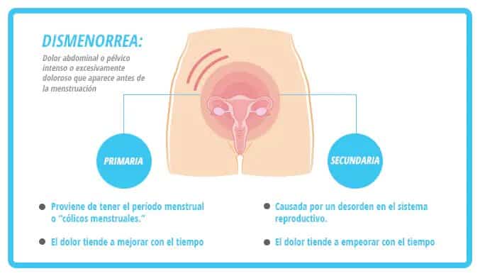 Los dolores menstruales pueden llegar a ser incapacitantes, lo cual es “un problema de salud pública y un obstáculo a la participación laboral de las mujeres”