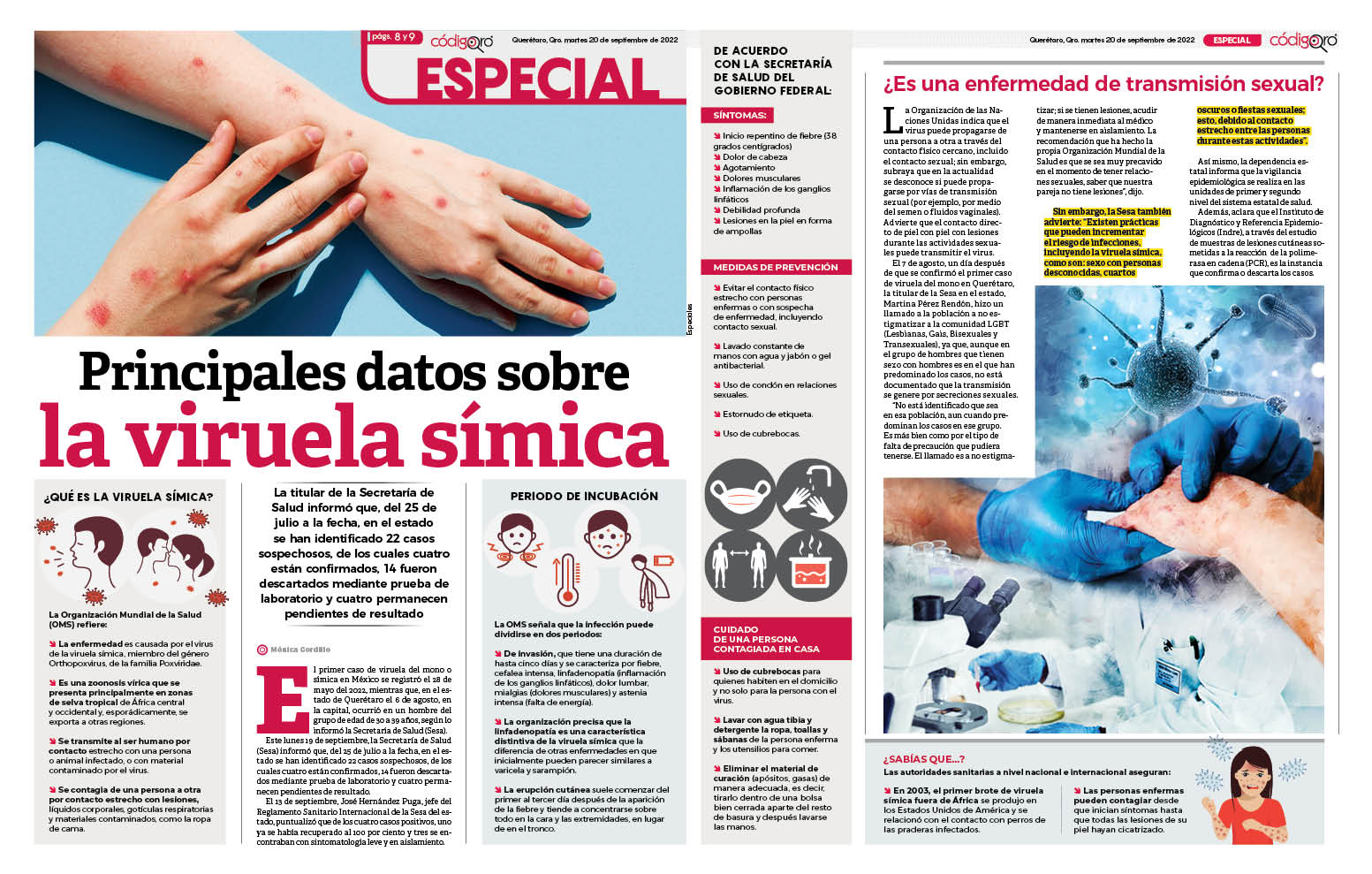 Principales datos sobre la viruela símica 