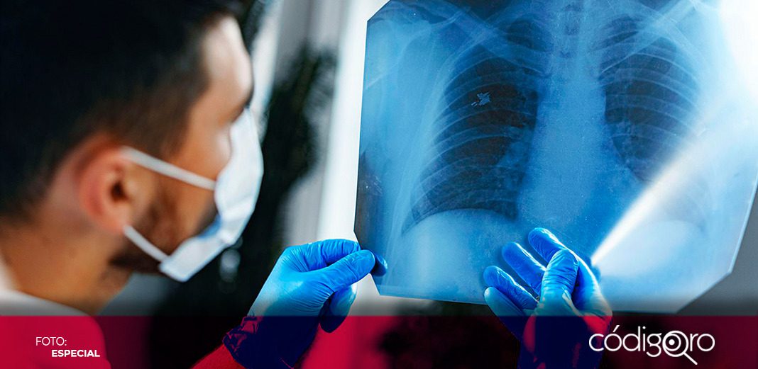 Salud conmemora Día Nacional contra Cáncer de Pulmón