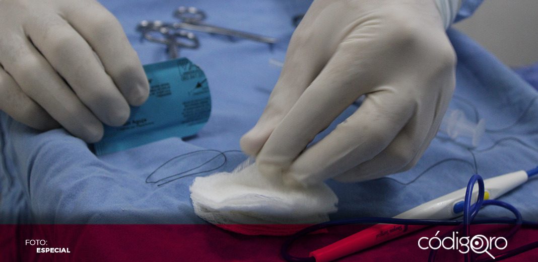 Anuncia IMSS Querétaro Jornada de Vasectomía sin BisturÍ
