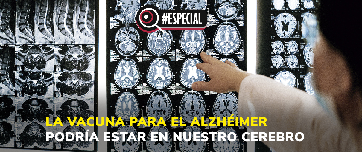 La vacuna para el alzhéimer podría estar en nuestro cerebro