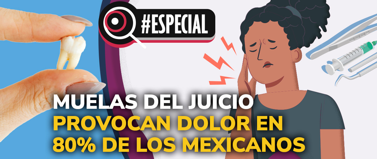 Muelas del juicio provocan dolor en 80% de los mexicanos
